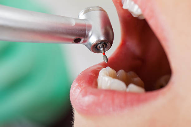Best Emergency Treatment for Toothache in Greenville, MI